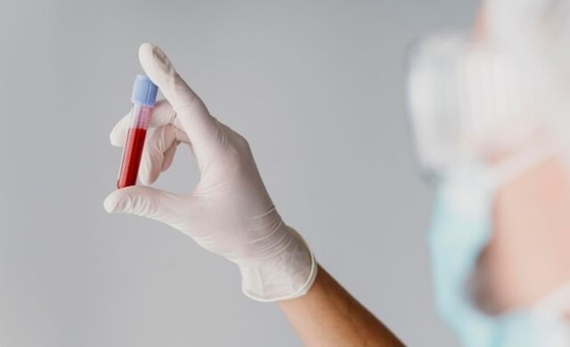 ¿Tienes hierro bajo aunque no tengas anemia? La nueva guía médica cambia el umbral