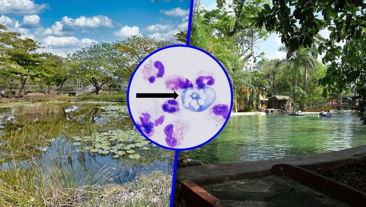 Clausuran 6 lagos artificiales en Mérida por ameba comecerebros Naegleria fowleri